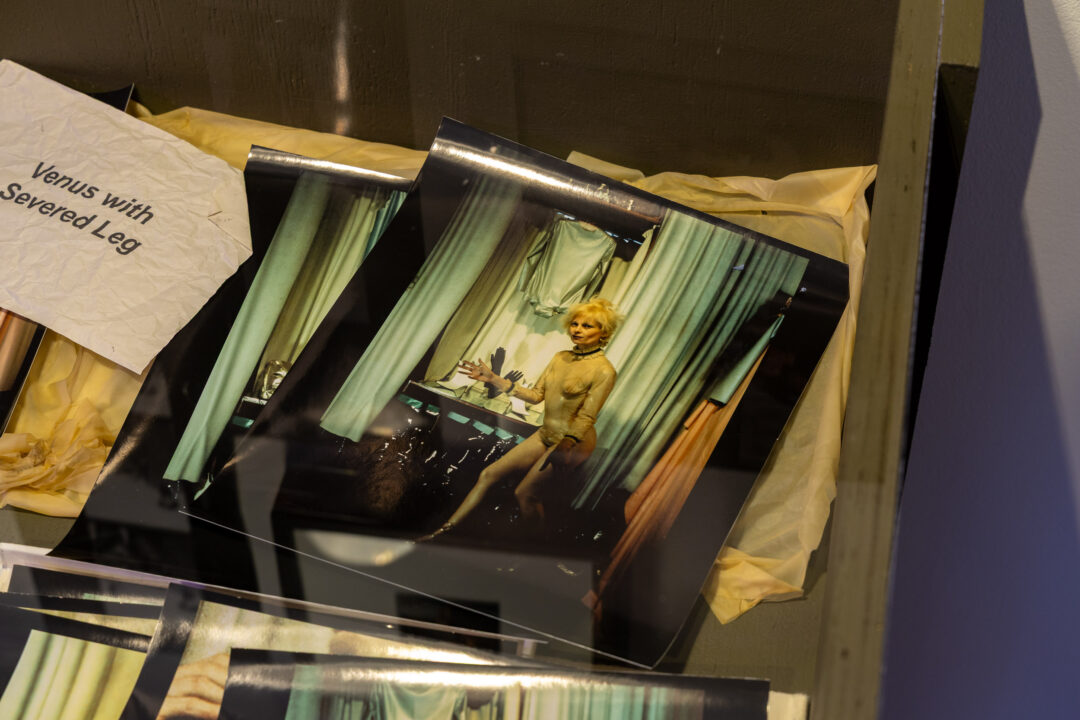 William English, Venus with Severed Leg, 1975